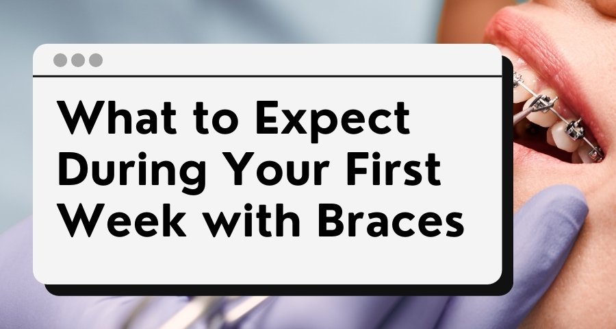 teeth braces singapore