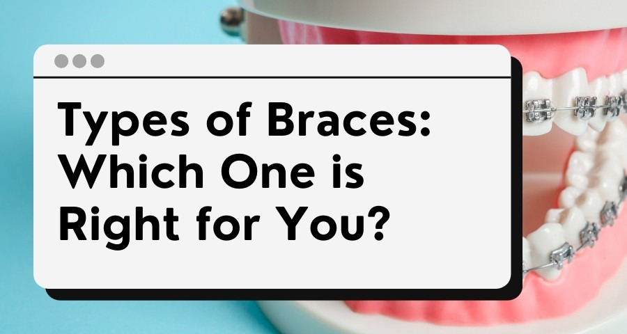 teeth braces singapore