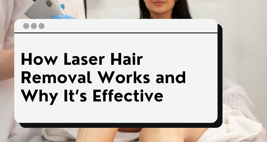 laser hair removal singapore