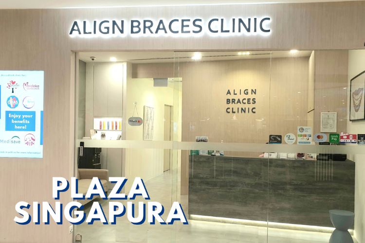 Align Braces Clinic